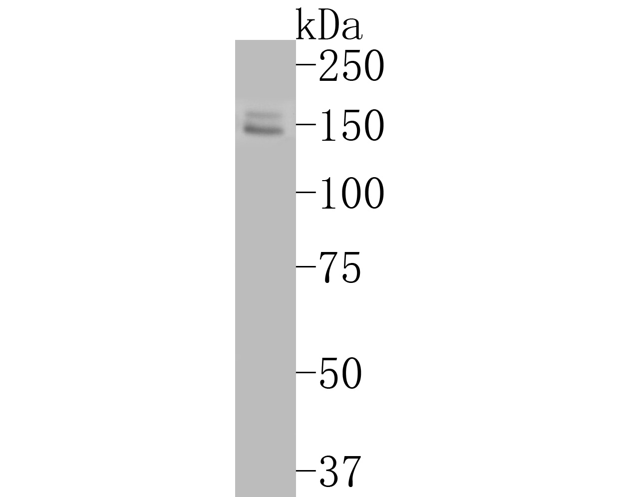 Fig1:; Western blot analysis of FYCO1 on SK-Br-3 cell lysates. Proteins were transferred to a PVDF membrane and blocked with 5% BSA in PBS for 1 hour at room temperature. The primary antibody ( 1/500) was used in 5% BSA at room temperature for 2 hours. Goat Anti-Rabbit IgG - HRP Secondary Antibody (HA1001) at 1:5,000 dilution was used for 1 hour at room temperature.