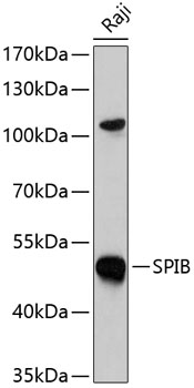 Western blot - SPIB Polyclonal Antibody 