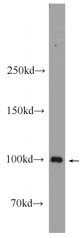 mouse skeletal muscle tissue were subjected to SDS PAGE followed by western blot with Catalog No:107711(ACTN3 Antibody) at dilution of 1:300