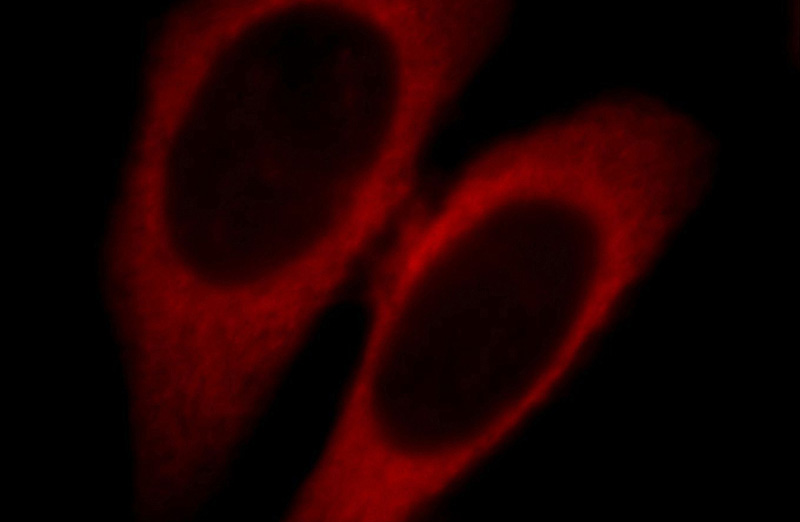 Immunofluorescent analysis of Hela cells, using SMCR7L antibody Catalog No:115387 at 1:25 dilution and Rhodamine-labeled goat anti-rabbit IgG (red).