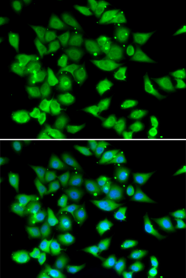 Immunofluorescence - NFATC3 Polyclonal Antibody 