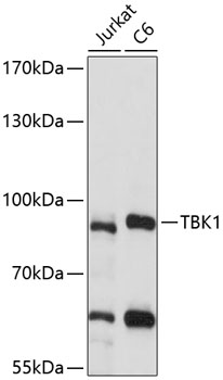Western blot - TBK1 Polyclonal Antibody 
