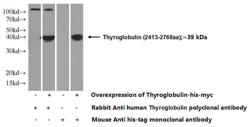 Transfected HEK-293 cells were subjected to SDS PAGE followed by western blot with Catalog No:116117(TG Antibody) at dilution of 1:1000