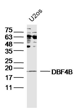 Fig3: Sample: U2os Cell (Human) Lysate at 30 ug; Primary: Anti-DBF4B at 1/300 dilution; Secondary: IRDye800CW Goat Anti-Rabbit IgG at 1/20000 dilution; Predicted band size: 18kD; Observed band size: 18kD