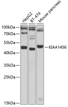 Western blot - KIAA1456 Polyclonal Antibody 