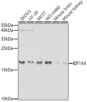 Western blot - EIF1AX Polyclonal Antibody 