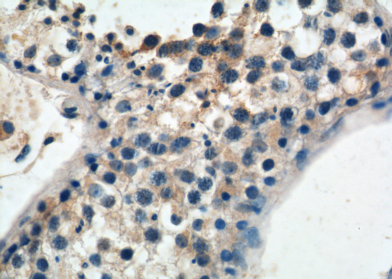 Immunohistochemistry of paraffin-embedded human testis tissue slide using Catalog No:116867(WDR40A Antibody) at dilution of 1:50 (under 40x lens)