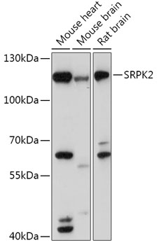 Western blot - SRPK2 Polyclonal Antibody 