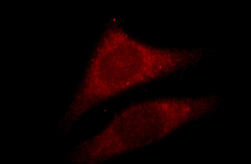 Immunofluorescent analysis of HepG2 cells, using MVP antibody Catalog No:112907 at 1:25 dilution and Rhodamine-labeled goat anti-rabbit IgG (red).
