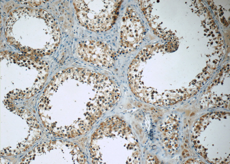 Immunohistochemistry of paraffin-embedded human testis tissue slide using Catalog No:115938(TEKT3 Antibody) at dilution of 1:50 (under 10x lens)