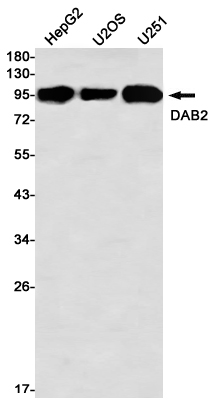 Western blot detection of DAB2 in HepG2,U2OS,U251 using DAB2 Rabbit mAb(1:1000 diluted)