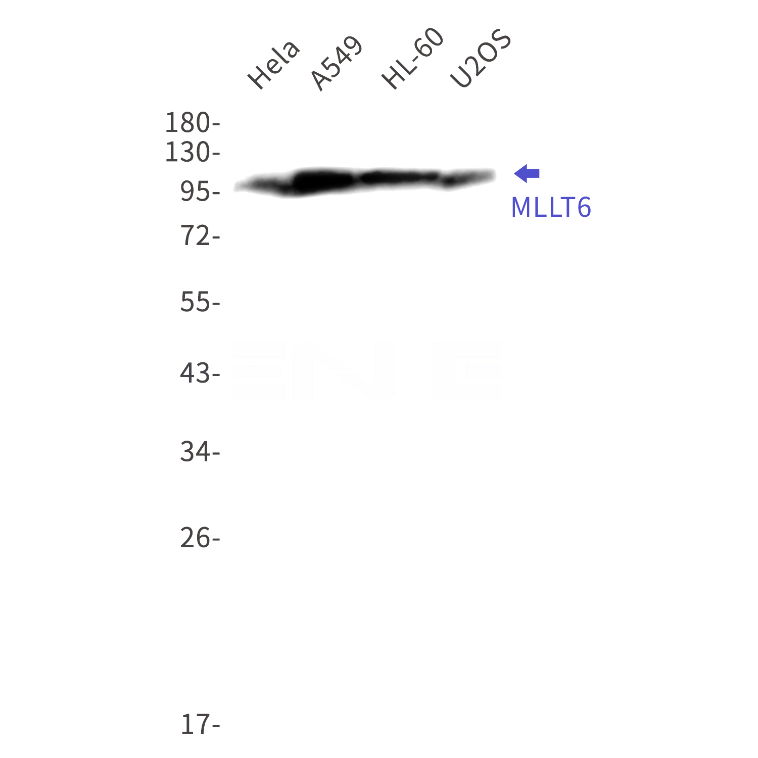Western blot detection of  MLLT6 in Hela,A549,HL-60,U2OS cell lysates using MLLT6 Rabbit mAb(1:1000 diluted).Predicted band size:112kDa.Observed band size:112kDa.