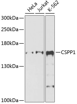 Western blot - CSPP1 Polyclonal Antibody 