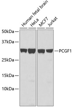 Western blot - PCGF1 Polyclonal Antibody 