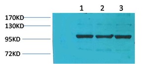 Fig1:; Western blot analysis of 1) Pig Skeletal MuscleTissue, 2) Rat Skeletal Muscle Tissue, 3) Rat Skeletal Muscle Tissue using IGFN1 Polyclonal Antibody.. Secondary antibody（catalog#: HA1001) was diluted at 1:20000