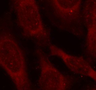 Immunofluorescence - Phospho-CARM1-S228 pAb 