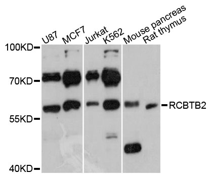 Western blot - RCBTB2 Polyclonal Antibody 