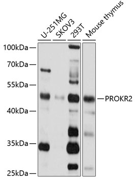 Western blot - PROKR2 Polyclonal Antibody 