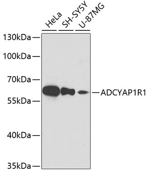 Western blot - ADCYAP1R1 Polyclonal Antibody 