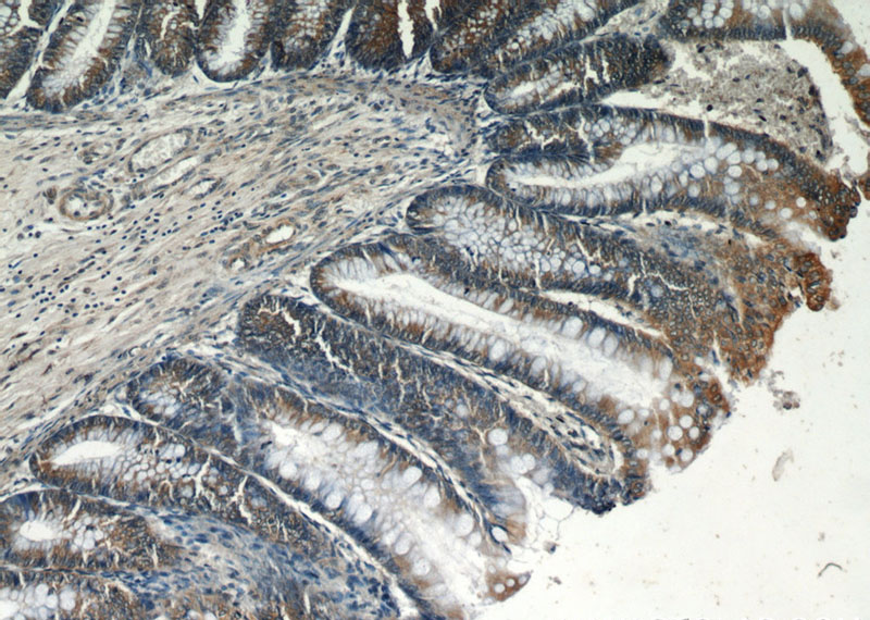 Immunohistochemical of paraffin-embedded human colon using Catalog No:114009(PLS1 antibody) at dilution of 1:50 (under 10x lens)