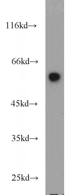 HeLa cells were subjected to SDS PAGE followed by western blot with Catalog No:110676(FKBP52 antibody) at dilution of 1:1000