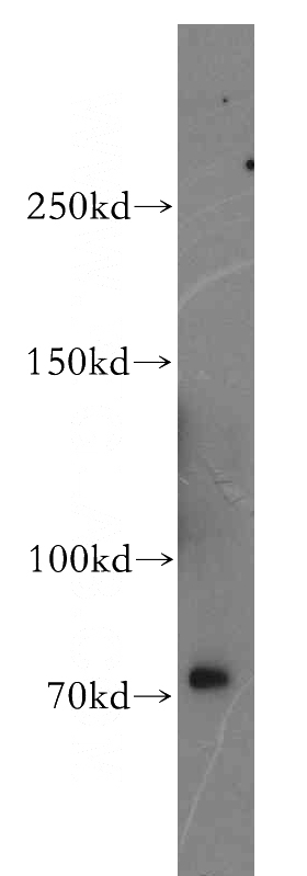 mouse stomach tissue were subjected to SDS PAGE followed by western blot with Catalog No:114774(ROBO3 antibody) at dilution of 1:200