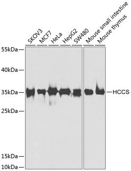 Western blot - HCCS Polyclonal Antibody 