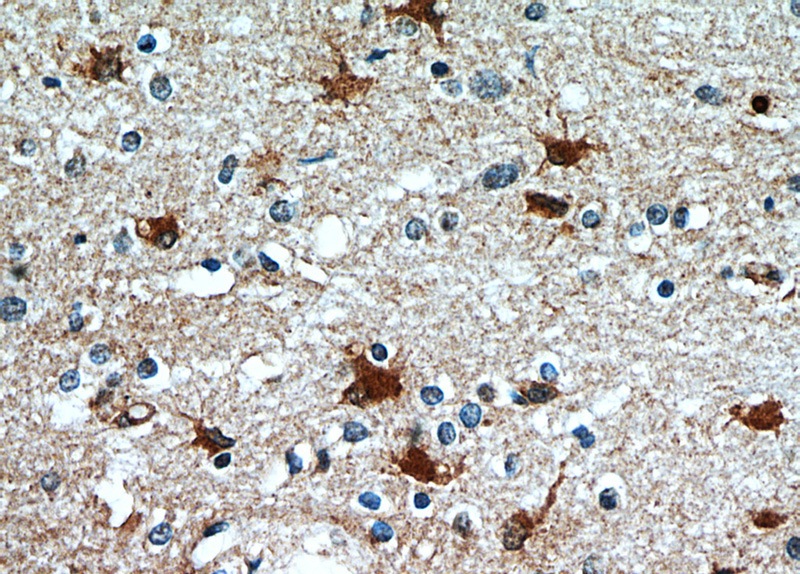 Immunohistochemical of paraffin-embedded human brain using Catalog No:114993(SCGBL antibody) at dilution of 1:50 (under 40x lens)