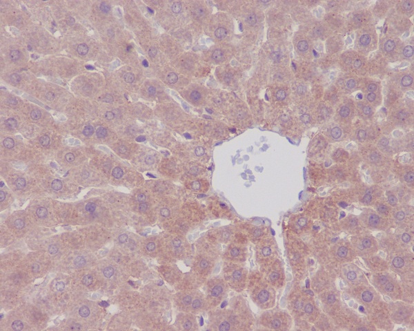 Immunohistochemical analysis of paraffin-embedded rat liver, using mTOR Antibody.