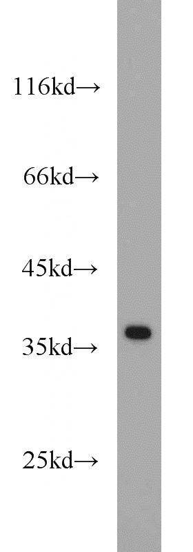 HepG2 cells were subjected to SDS PAGE followed by western blot with Catalog No:108138(APEX1 antibody) at dilution of 1:500