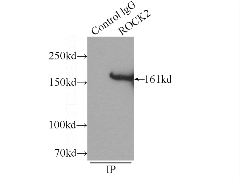 IP Result of anti-RocK2 (IP:Catalog No:114779, 5ug; Detection:Catalog No:114779 1:700) with HeLa cells lysate 1320ug.
