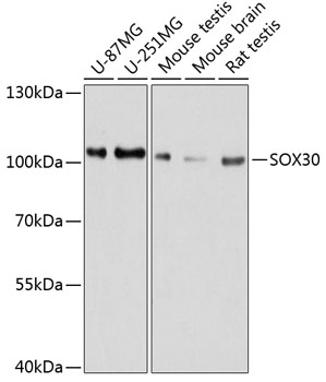 Western blot - SOX30 Polyclonal Antibody 