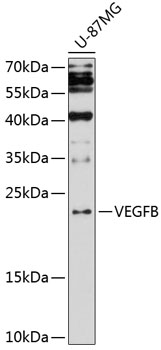 Western blot - VEGFB Polyclonal Antibody 