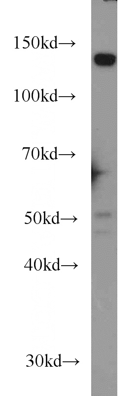 HeLa cells were subjected to SDS PAGE followed by western blot with Catalog No:107634(TPP2 antibody) at dilution of 1:1000