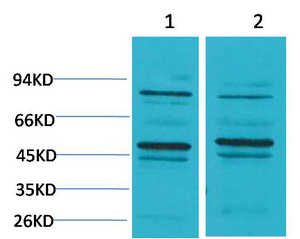 Fig1:; Western blot analysis of 1) Mouse Brain Tissue, 2) Rat Brain Tissue using BEST2 Polyclonal Antibody.. Secondary antibody（catalog#: HA1001) was diluted at 1:20000