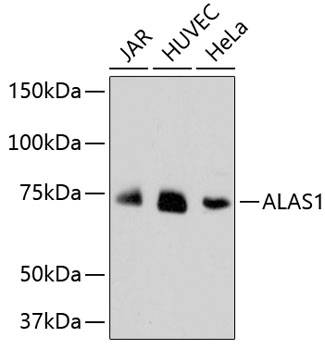 Western blot - ALAS1 Monoclonal Antibody 