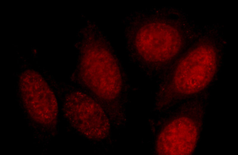 Immunofluorescent analysis of HepG2 cells using Catalog No:109966(DNMT1 Antibody) at dilution of 1:25 and Rhodamine-Goat anti-Rabbit IgG