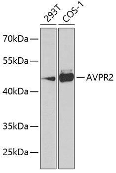 Western blot - AVPR2 Polyclonal Antibody 
