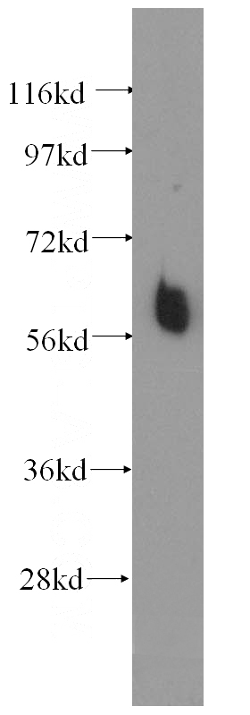 human thyroid gland tissue were subjected to SDS PAGE followed by western blot with Catalog No:111755(ILVBL antibody) at dilution of 1:500