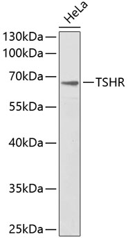 Western blot - TSHR Polyclonal Antibody 
