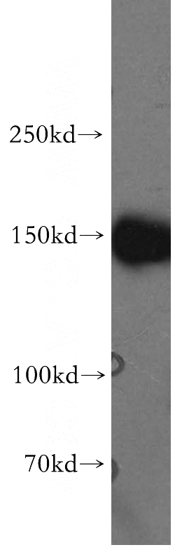 Jurkat cells were subjected to SDS PAGE followed by western blot with Catalog No:112491(MAST3 antibody) at dilution of 1:500