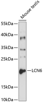 Western blot - LCN6 Polyclonal Antibody 