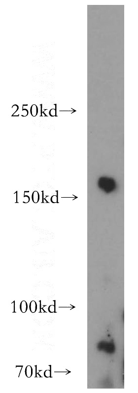 SH-SY5Y cells were subjected to SDS PAGE followed by western blot with Catalog No:115767(SYNJ2 antibody) at dilution of 1:500
