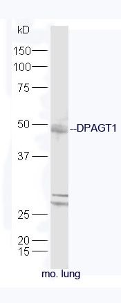Fig1: Protein: lung(mouse) lysate at 40ug;; Primary: rabbit Anti-DPAGT1 at 1:300;; Secondary: HRP conjugated Goat-Anti-rabbit IgG(bs-0295G-HRP) at 1: 5000;; Predicted band size: 46 kD; Observed band size: 46 kD