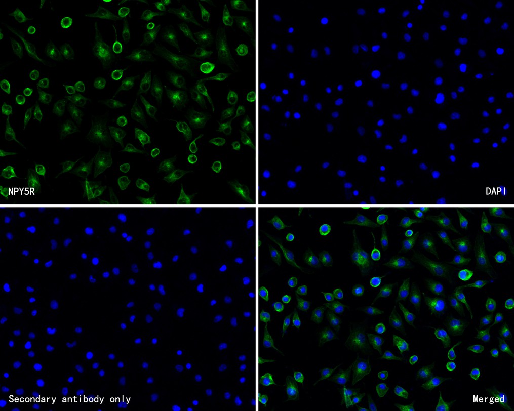 Fig2:; ICC staining of NPY5R in A549 cells (green). Formalin fixed cells were permeabilized with 0.1% Triton X-100 in TBS for 10 minutes at room temperature and blocked with 1% Blocker BSA for 15 minutes at room temperature. Cells were probed with the primary antibody ( 1/200) for 1 hour at room temperature, washed with PBS. Alexa Fluor®488 Goat anti-Rabbit IgG was used as the secondary antibody at 1/1,000 dilution. The nuclear counter stain is DAPI (blue).