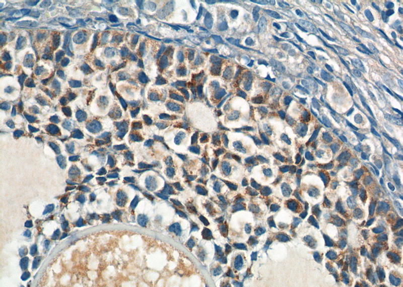 Immunohistochemistry of paraffin-embedded human ovary tissue slide using Catalog No:107992(AMH Antibody) at dilution of 1:200 (under 40x lens)