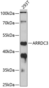 Western blot - ARRDC3 Polyclonal Antibody 