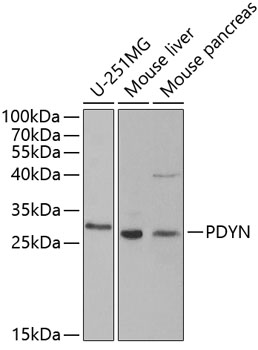 Western blot - PDYN Polyclonal Antibody 