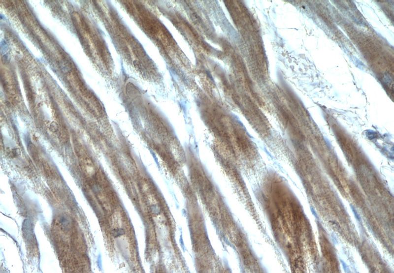 Immunohistochemistry of paraffin-embedded human heart tissue slide using Catalog No:114403(QSOX1 Antibody) at dilution of 1:50 (under 40x lens)
