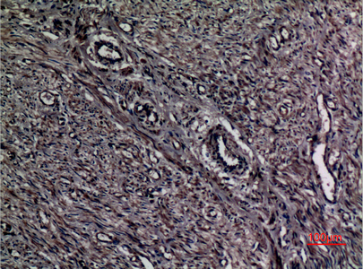 Immunohistochemical analysis of paraffin-embedded human-uterus, antibody was diluted at 1:100